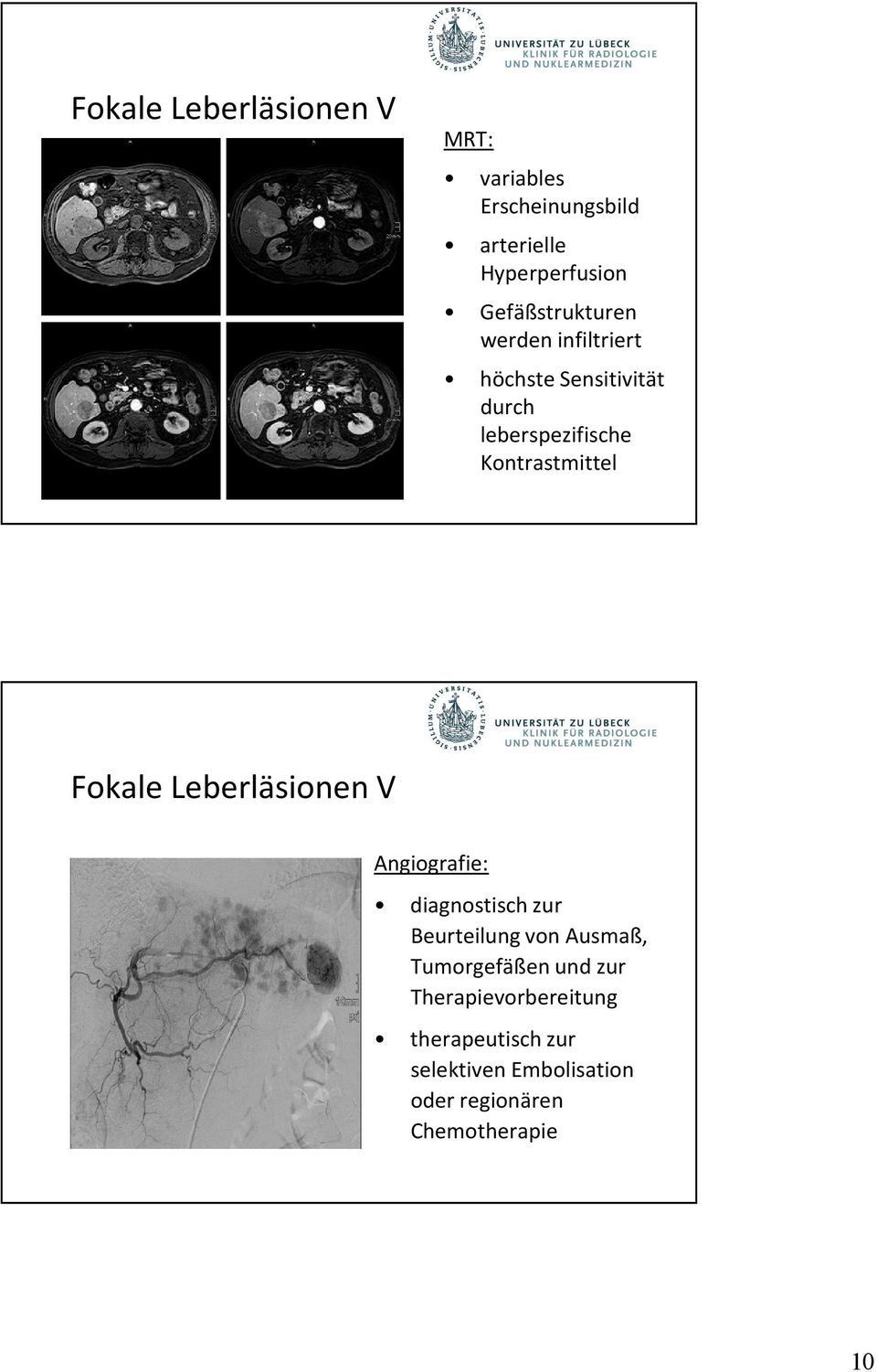 Kontrastmittel Fokale Leberläsionen V Angiografie: diagnostisch zur Beurteilung von Ausmaß,