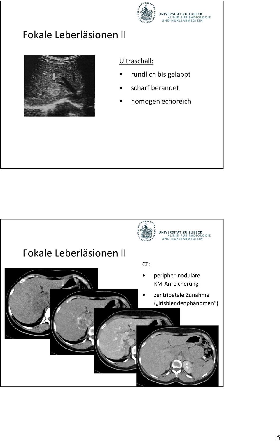 Fokale Leberläsionen II peripher-noduläre