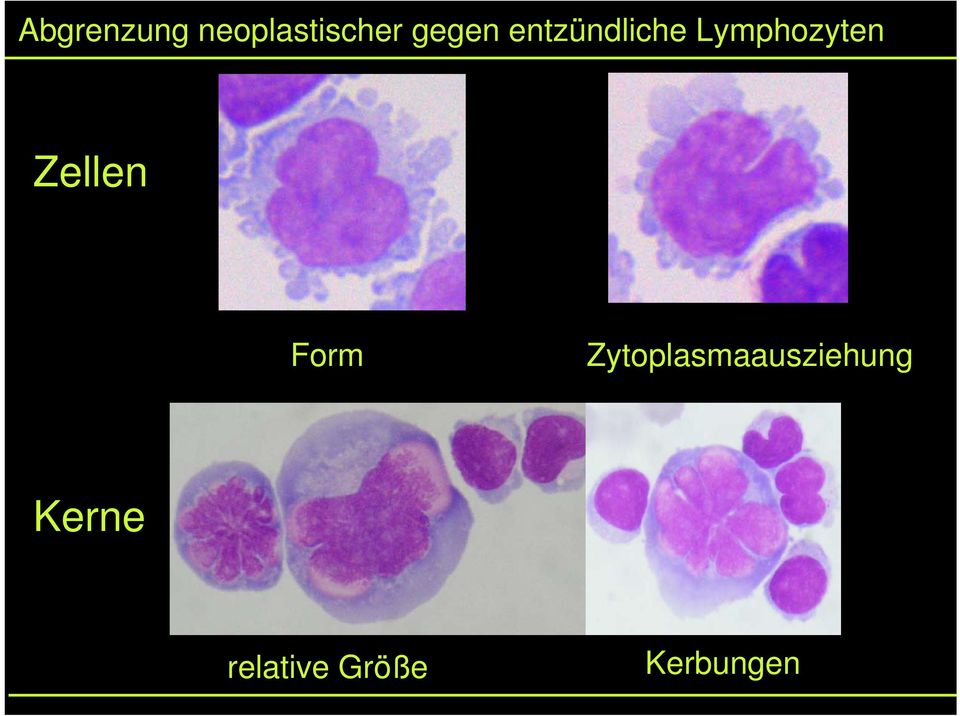 Lymphozyten Zellen Form