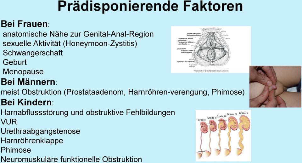 (Prostataadenom, Harnröhren-verengung, Phimose) Bei Kindern: Harnabflussstörung und obstruktive