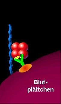 Heparin-induzierte Thrombozytopenie (HIT) Eliminierung von Blutplättchen über Milz