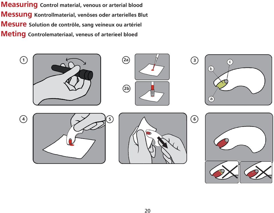 Mesure Solution de contrôle, sang veineux ou artériel