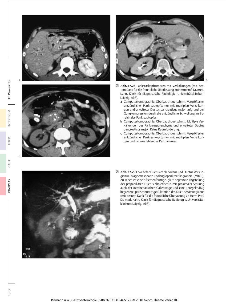 6 Dünn- und Dickdarm Kahn, Klinik für diagnostische Radiologie, Universitätsklinikum Leipzig, AöR). a Computertomographie, Oberbauchquerschnitt.