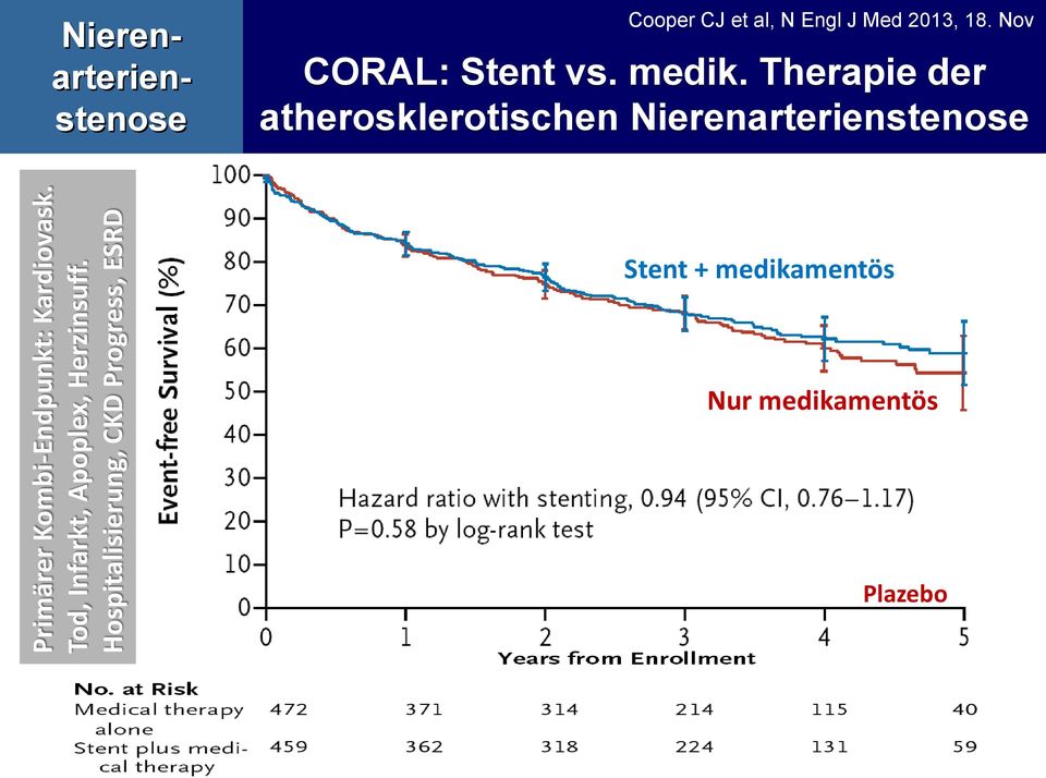 al, N Engl J Med 2013, 18. Nov CORAL: Stent vs. medik.