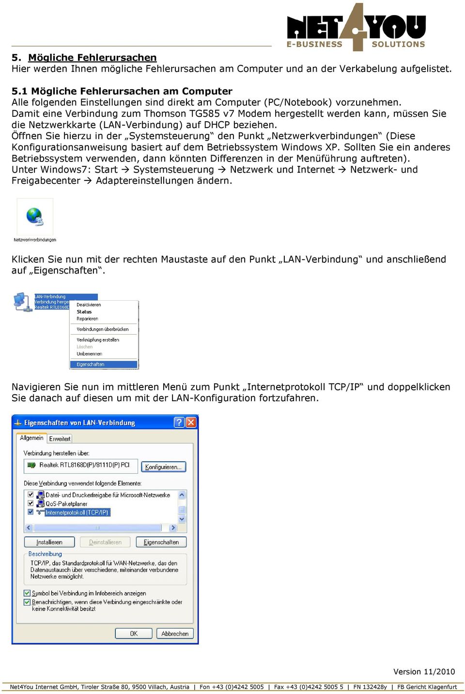 Damit eine Verbindung zum Thomson TG585 v7 Modem hergestellt werden kann, müssen Sie die Netzwerkkarte (LAN-Verbindung) auf DHCP beziehen.