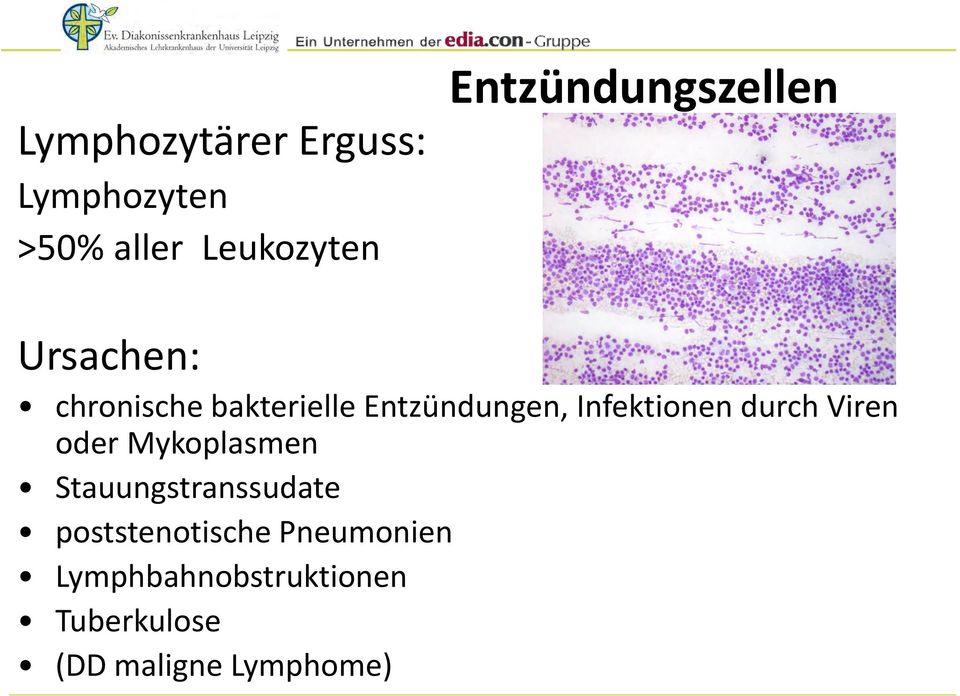 Infektionen durch Viren oder Mykoplasmen Stauungstranssudate