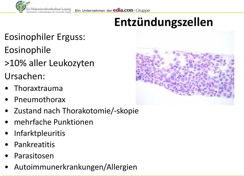 Thorakotomie/-skopie mehrfache Punktionen Infarktpleuritis