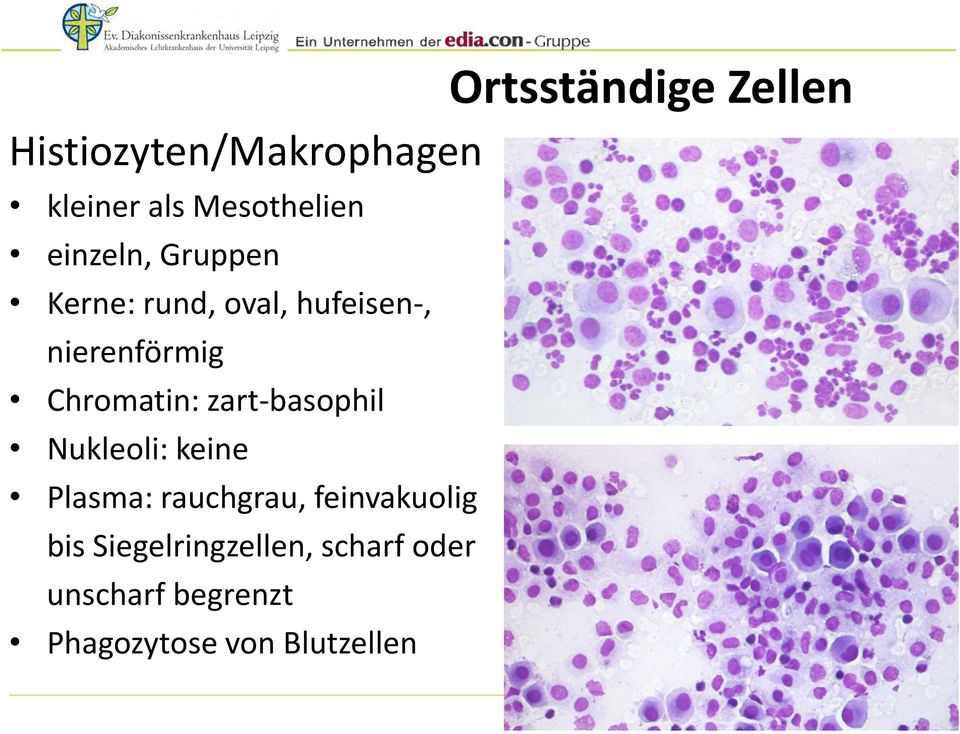 Chromatin: zart-basophil Nukleoli: keine Plasma: rauchgrau,