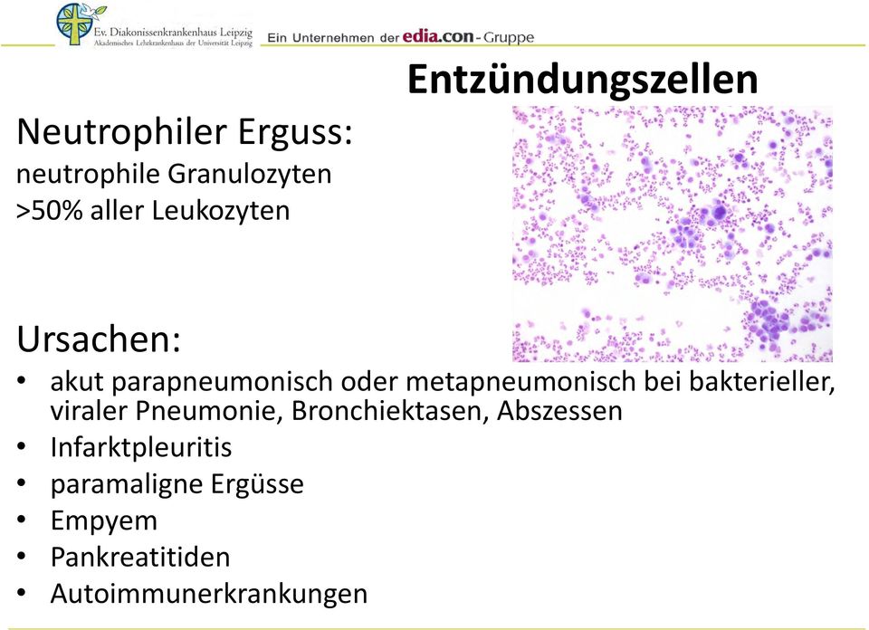 bei bakterieller, viraler Pneumonie, Bronchiektasen, Abszessen