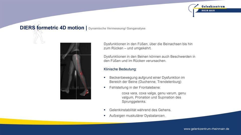 Klinische Bedeutung: Beckenbewegung aufgrund einer Dysfunktion im Bereich der Beine (Duchenne, Trendelenburg) Fehlstellung in der