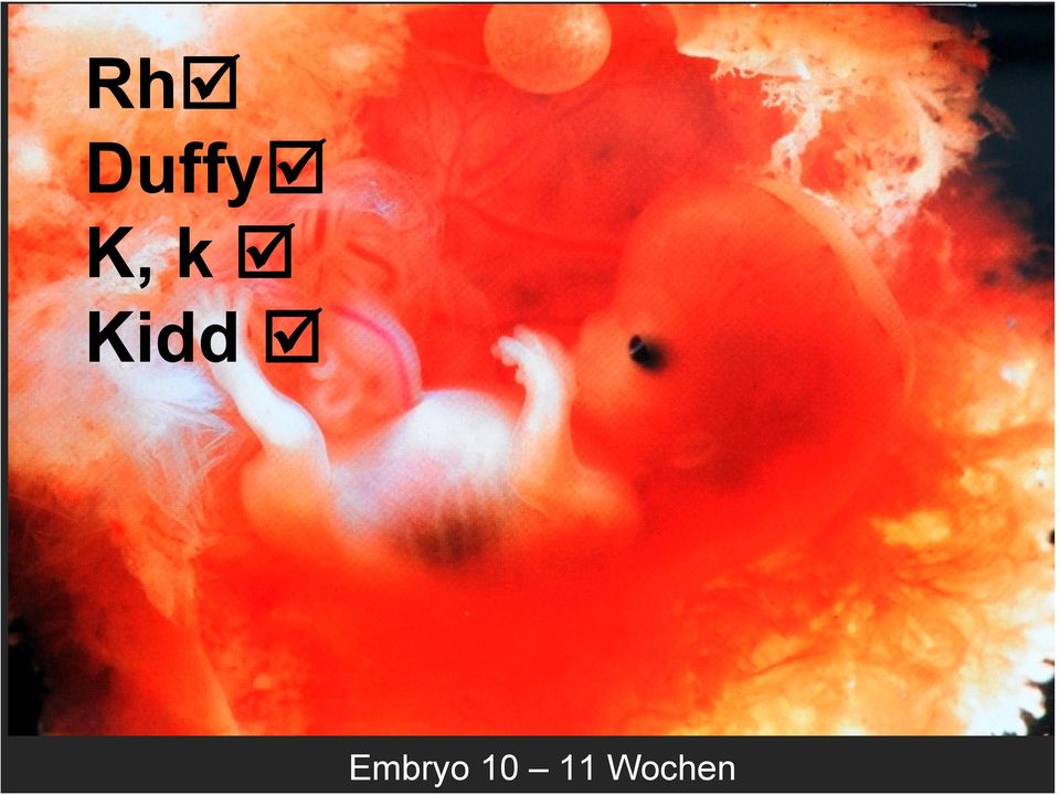 Embryo 10