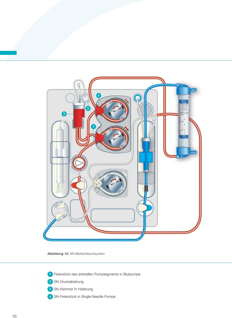 Blutpumpe 2 SN-Druckableitung 3 SN-Kammer in