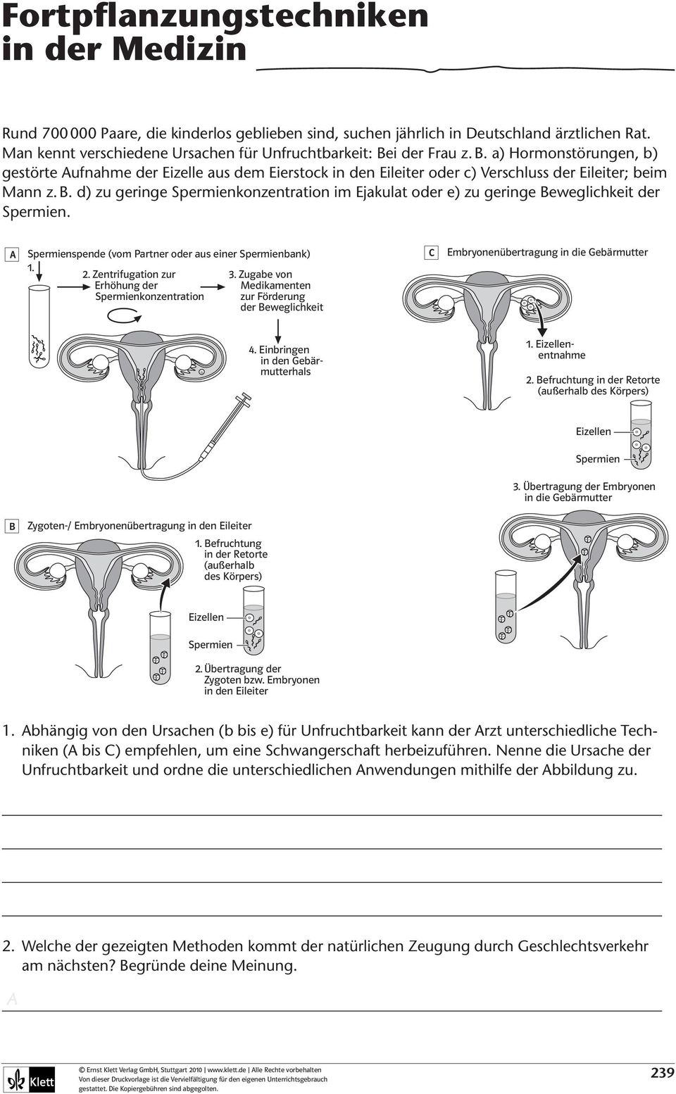 B. d) zu geringe Spermienkonzentration im Ejakulat oder e) zu geringe Beweglichkeit der Spermien. A Spermienspende (vom Partner oder aus einer Spermienbank) 1. 2. Zentrifugation zur 3.