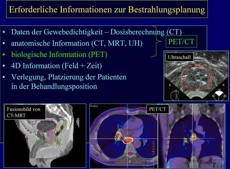 PET/CT biologische Information (PET) 4D Information (Feld + Zeit) Verlegung,