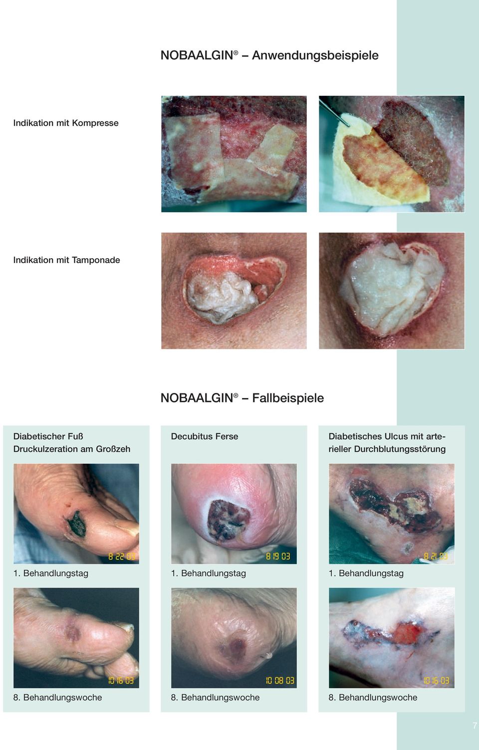 arterieller Durchblutungsstörung 1. Behandlungstag 8 22 03 1. Behandlungstag 8 19 03 1.