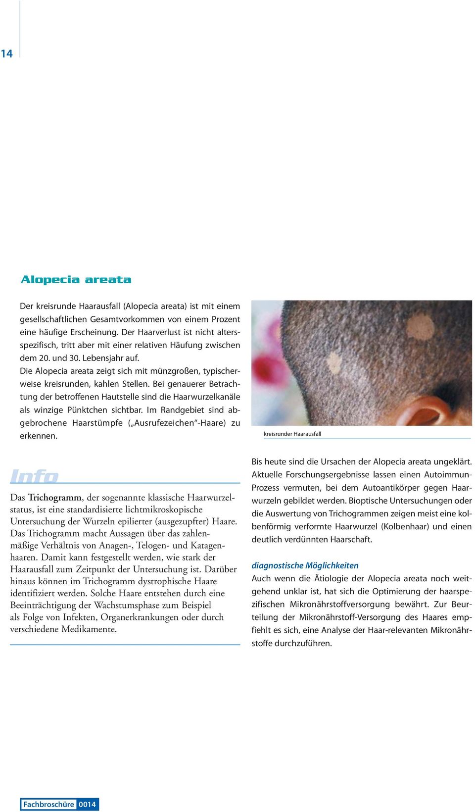 Die Alopecia areata zeigt sich mit münzgroßen, typischerweise kreisrunden, kahlen Stellen.