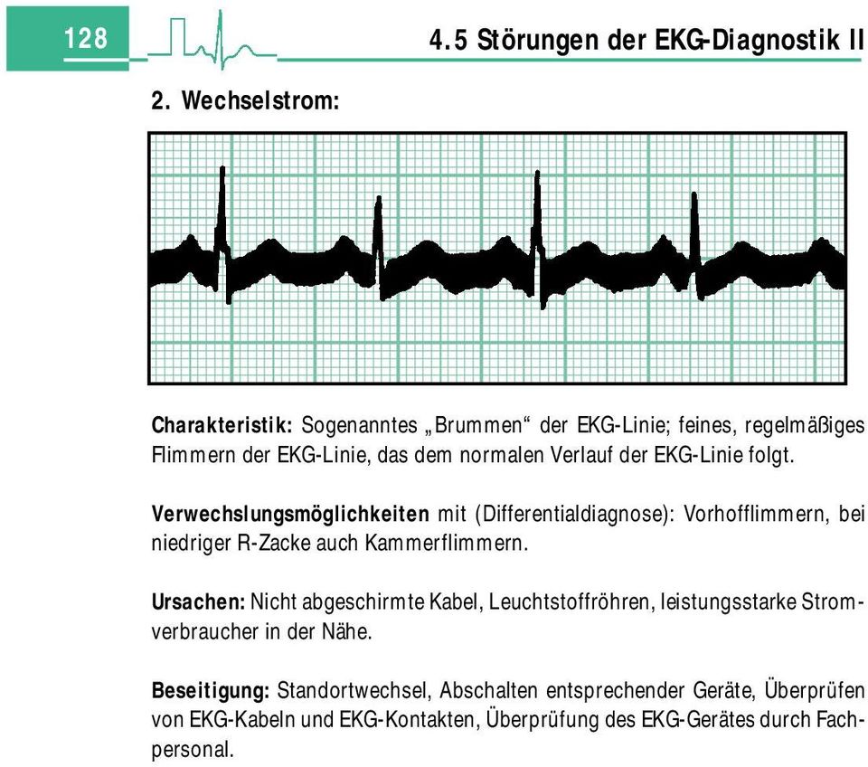 EKG-Linie folgt. Verwechslungsmöglichkeiten mit (Differentialdiagnose): Vorhofflimmern, bei niedriger R-Zacke auch Kammerflimmern.