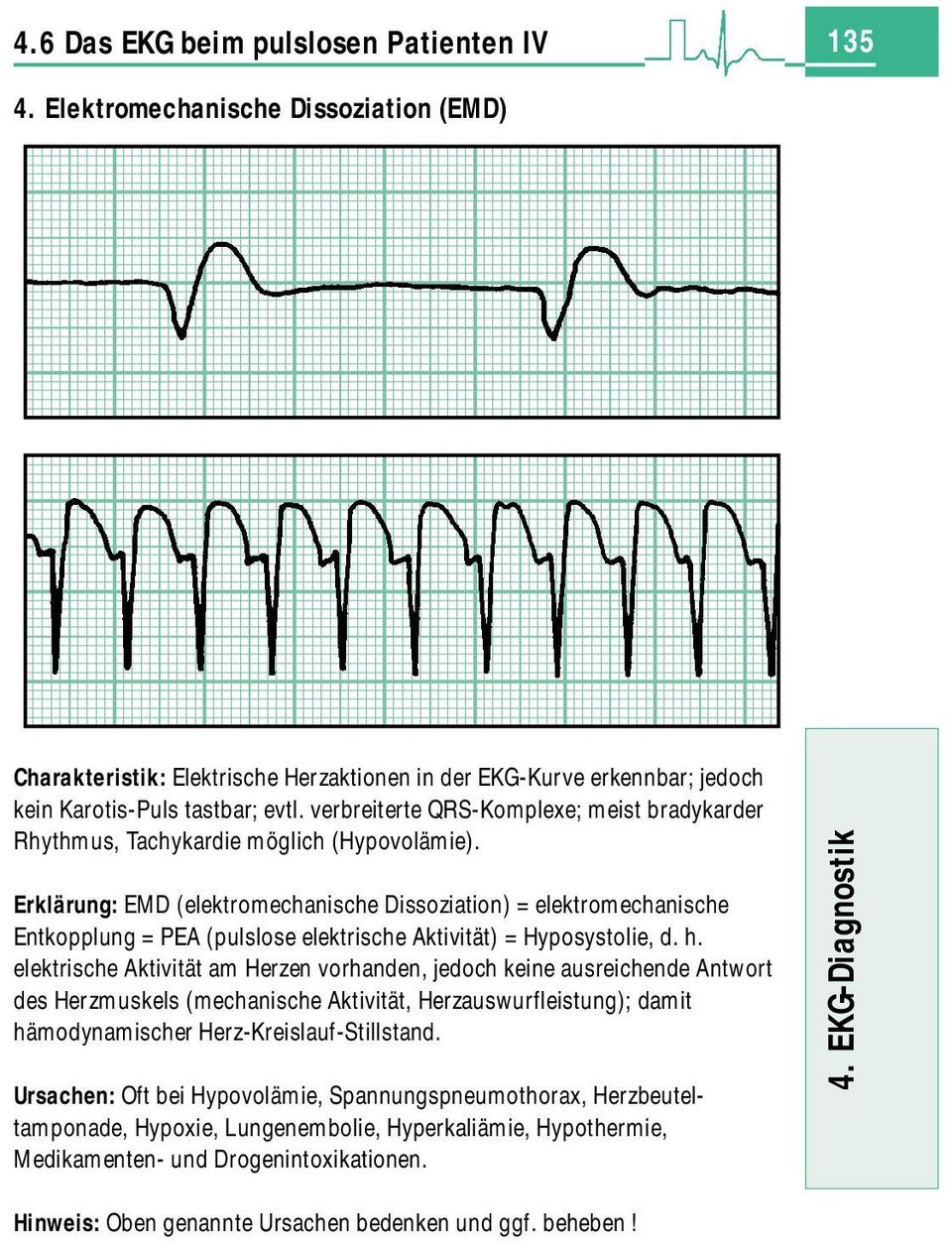Erklärung: EMD (elektromechanische Dissoziation) = elektromechanische Entkopplung = PEA (pulslose elektrische Aktivität) = Hyposystolie, d. h.