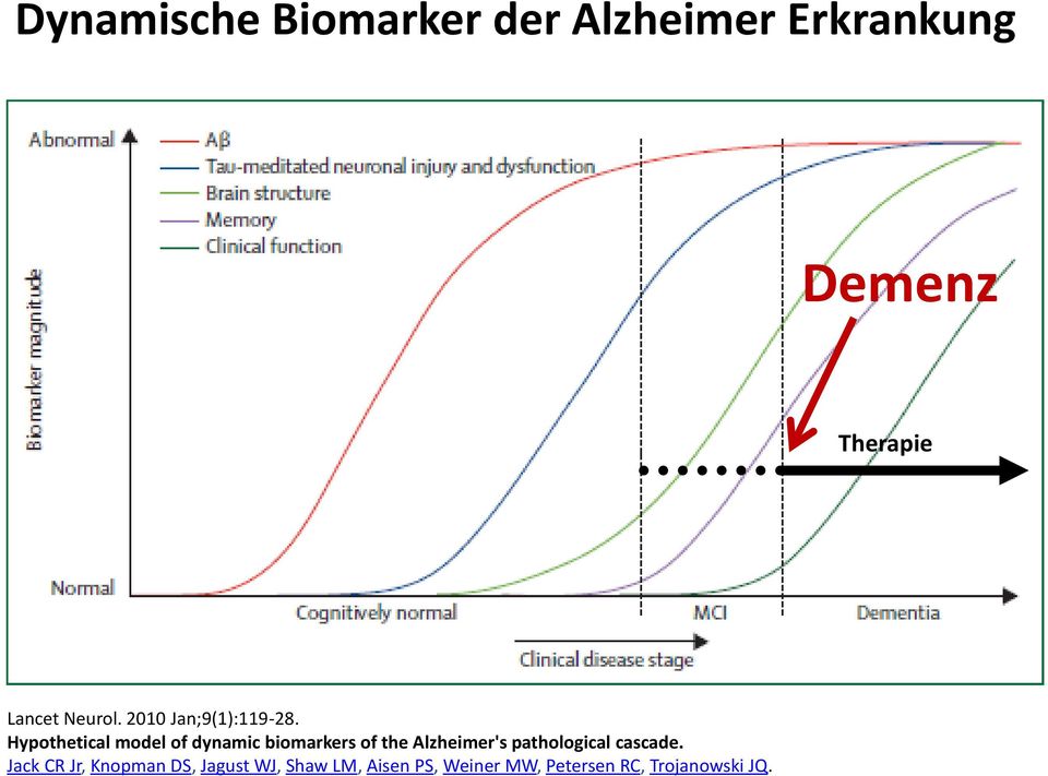 Hypothetical model of dynamic biomarkers of the Alzheimer's