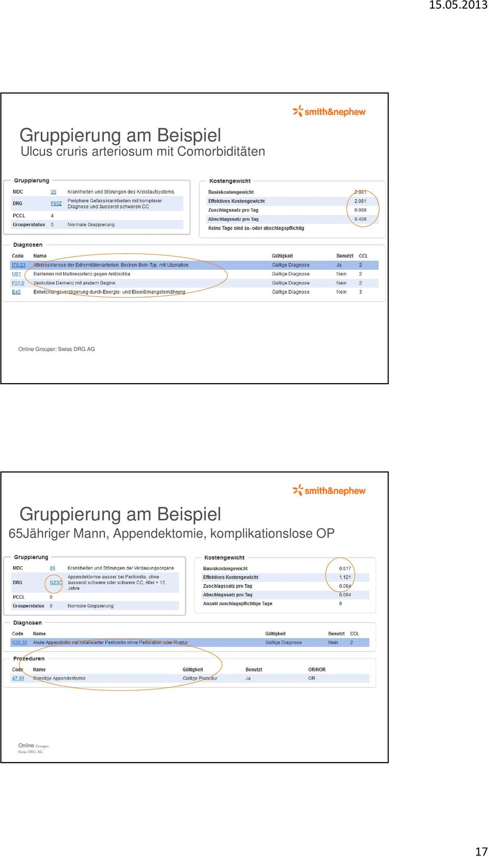 Gruppierung am Beispiel 65Jähriger Mann,