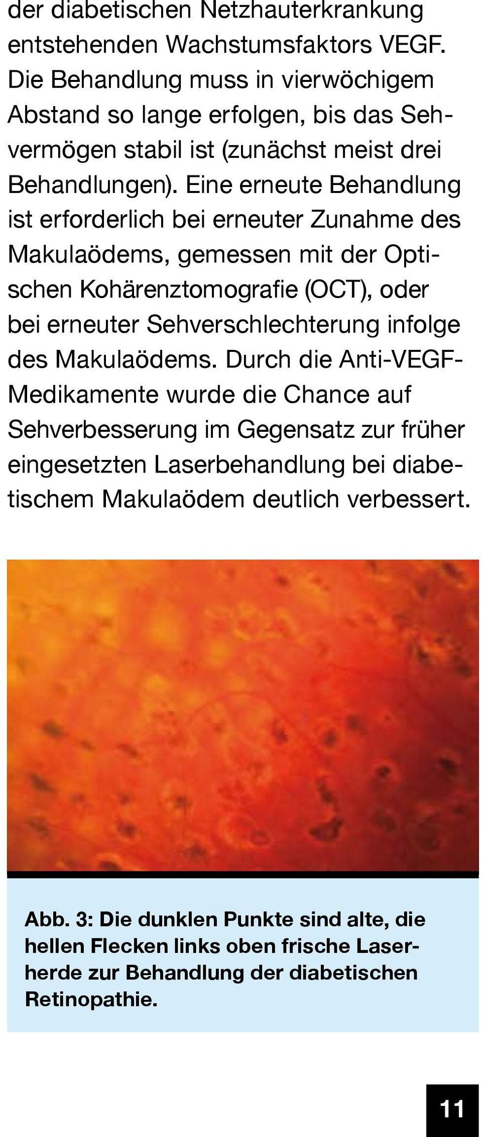 Eine erneute Behandlung ist erforderlich bei erneuter Zunahme des Makulaödems, gemessen mit der Optischen Kohärenztomografie (OCT), oder bei erneuter Sehverschlechterung