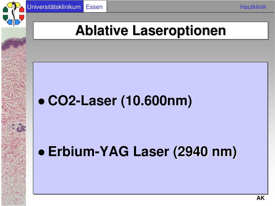 CO2-Laser (10.
