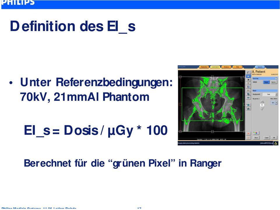 Phantom EI_s = Dosis / µgy * 100
