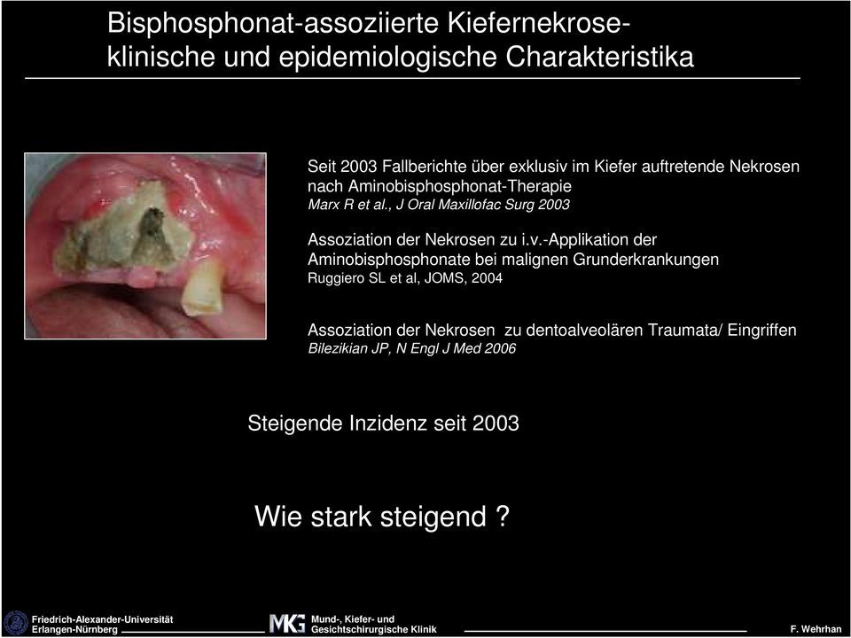 , J Oral Maxillofac Surg 2003 Assoziation der Nekrosen zu i.v.
