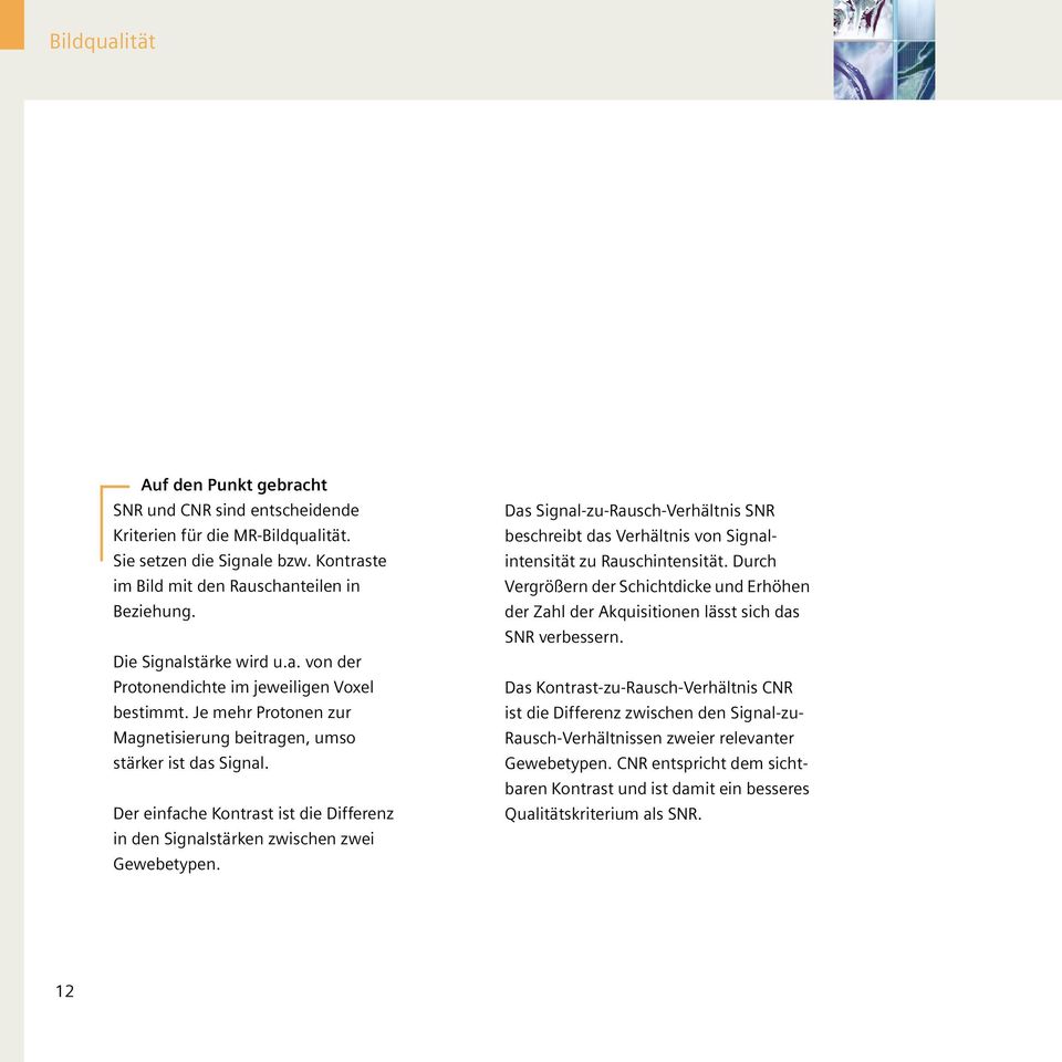Der einfache Kontrast ist die Differenz in den Signalstärken zwischen zwei Gewebetypen. Das Signal-zu-Rausch-Verhältnis SNR beschreibt das Verhältnis von Signalintensität zu Rauschintensität.