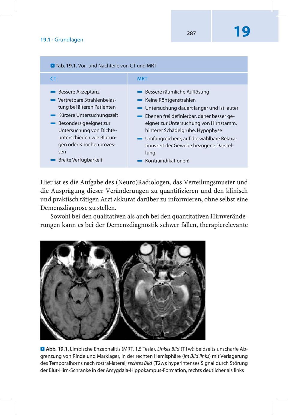 Vor- und Nachteile von CT und MRT CT 4 Bessere Akzeptanz 4 Vertretbare Strahlenbelastung bei älteren Patienten 4 Kürzere Untersuchungszeit 4 Besonders geeignet zur Untersuchung von