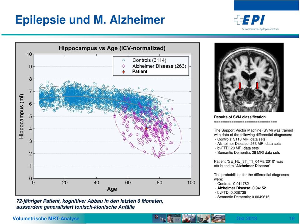 diagnoses: - Controls: 3113 MRI data sets - Alzheimer Disease: 263 MRI data sets - bvftd: 20 MRI data sets - Semantic Dementia: 28 MRI data sets Patient "SE_HU_3T_T1_04Mar2010"