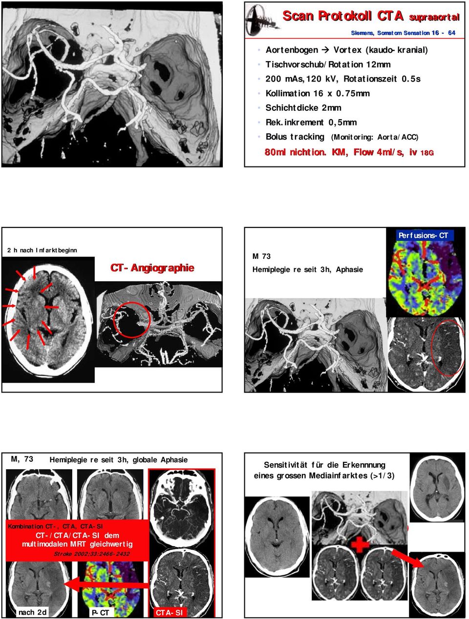 KM, Flow 4ml/s, iv 18G 2 h nach Infarktbeginn CT-Angiographie M 73 Hemiplegie re seit 3h, Aphasie Perfusions-CT QUELLENBILDER!