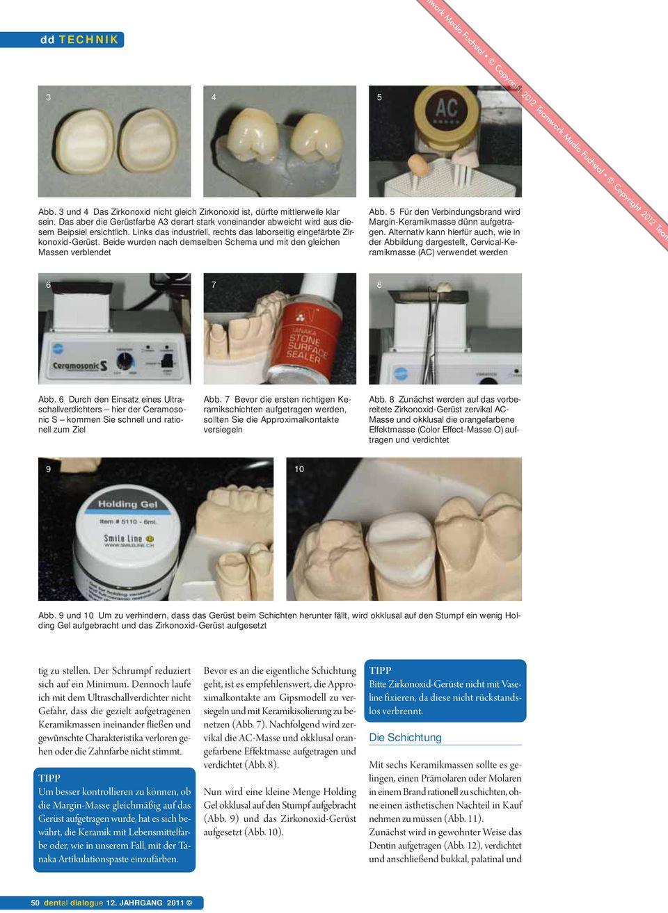 5 Für den Verbindungsbrand wird Margin-Keramikmasse dünn aufgetragen. Alternativ kann hierfür auch, wie in der Abbildung dargestellt, Cervical-Keramikmasse (AC) verwendet werden 6 7 8 Abb.
