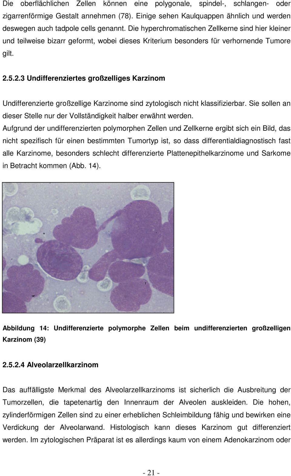 5.2.3 Undifferenziertes großzelliges Karzinom Undifferenzierte großzellige Karzinome sind zytologisch nicht klassifizierbar. Sie sollen an dieser Stelle nur der Vollständigkeit halber erwähnt werden.