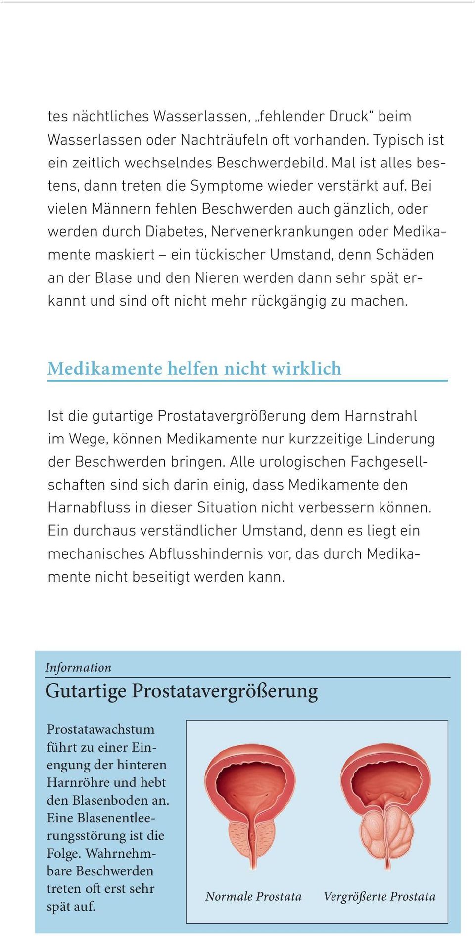 Bei vielen Männern fehlen Beschwerden auch gänzlich, oder werden durch Diabetes, Nervenerkrankungen oder Medikamente maskiert ein tückischer Umstand, denn Schäden an der Blase und den Nieren werden