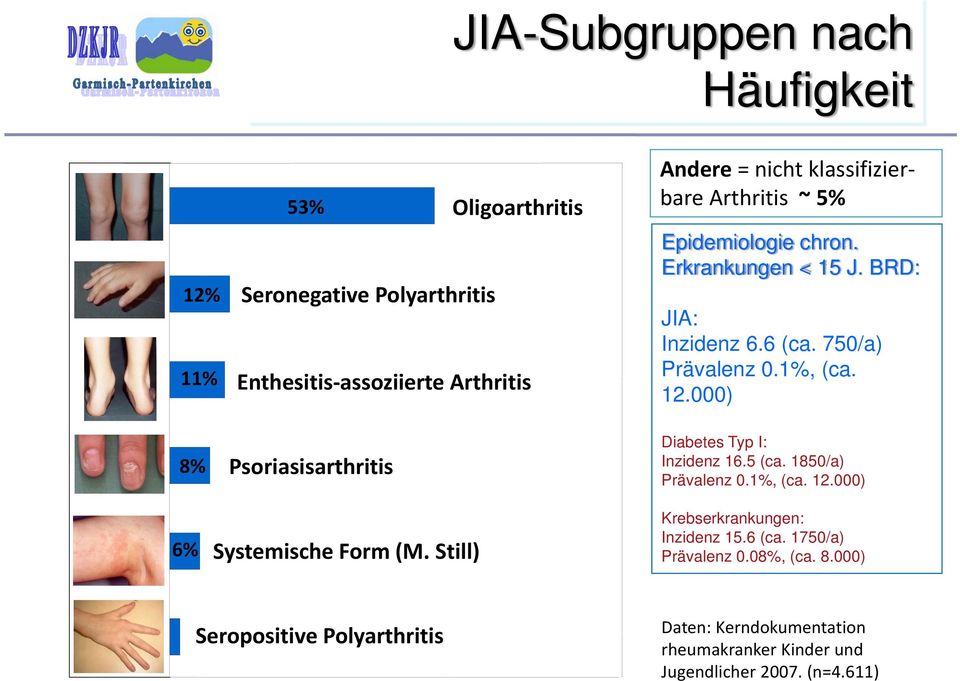 12.000) Diabetes Typ I: Inzidenz 16.5 (ca. 1850/a) Prävalenz 0.1%, (ca. 12.000) 6% Systemische Form (M. Still) Krebserkrankungen: Inzidenz 15.