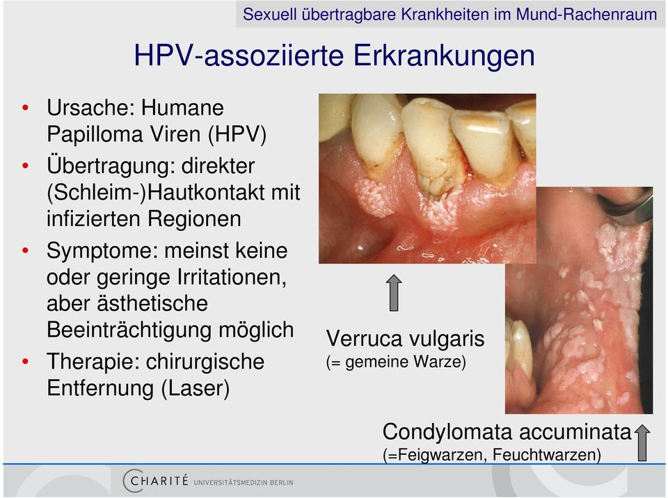 meinst keine oder geringe Irritationen, aber ästhetische Beeinträchtigung möglich Therapie: