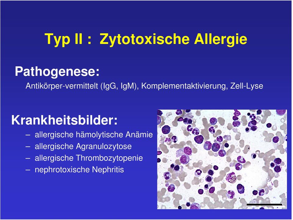 Zell-Lyse Krankheitsbilder: allergische hämolytische Anämie