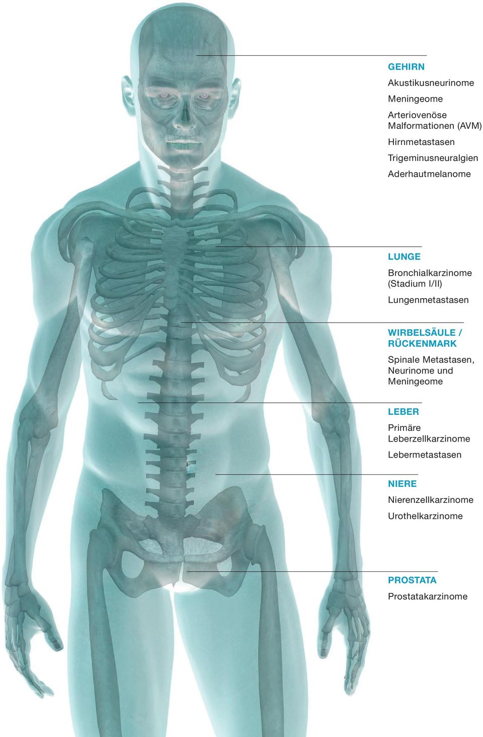 Lungenmetastasen WIRBELSÄULE / RÜCKENMARK Spinale Metastasen, Neurinome und Meningeome LEBER