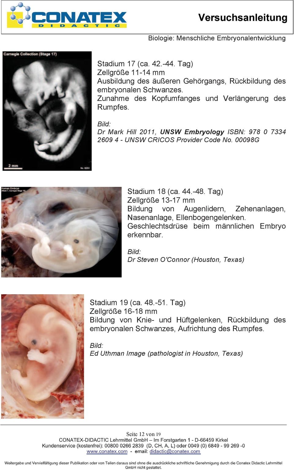 -48. Tag) Zellgröße 13-17 mm Bildung von Augenlidern, Zehenanlagen, Nasenanlage, Ellenbogengelenken. Geschlechtsdrüse beim männlichen Embryo erkennbar.