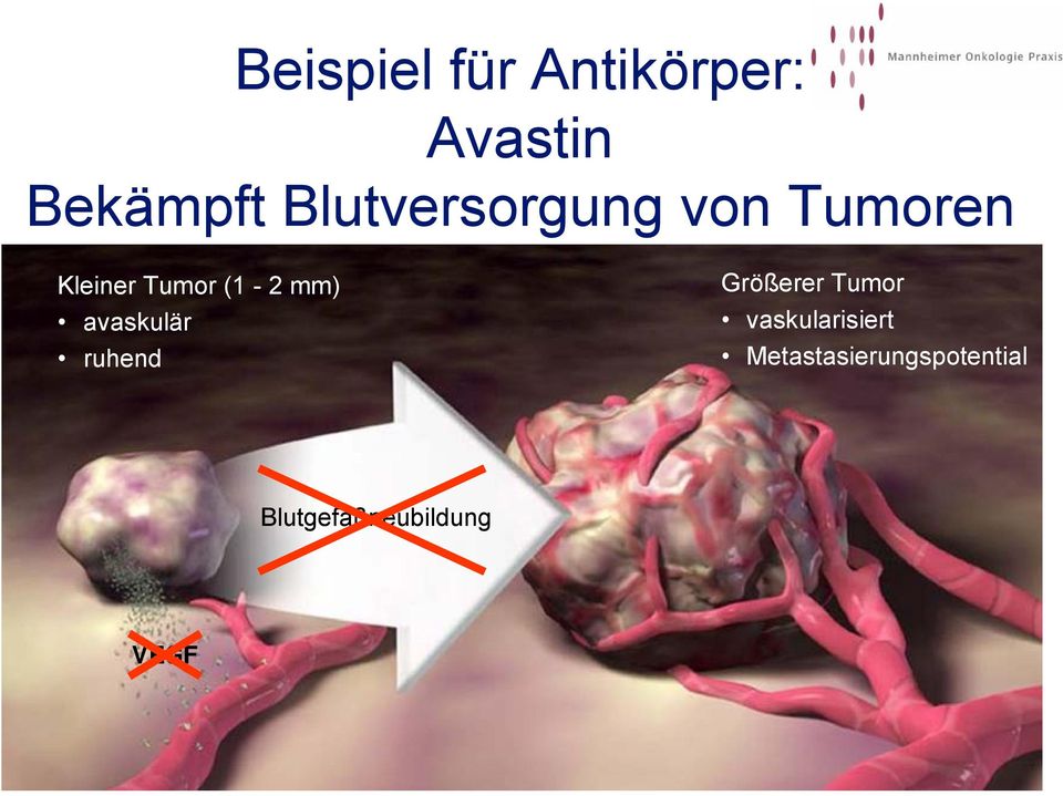 mm) avaskulär ruhend Größerer Tumor