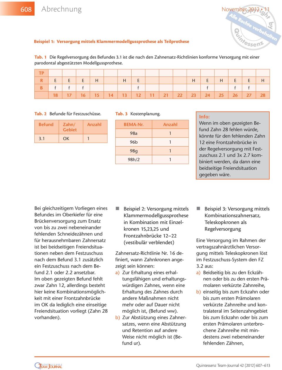 3 Kostenplanung. BEMA-Nr. 98a 96b 98g 98h/ Info: Wenn im oben gezeigten Zahn 8 fehlen würde, könnte für den fehlenden Zahn eine Frontzahnbrücke in der Regelversorgung mit Festzuschuss. und 3x.