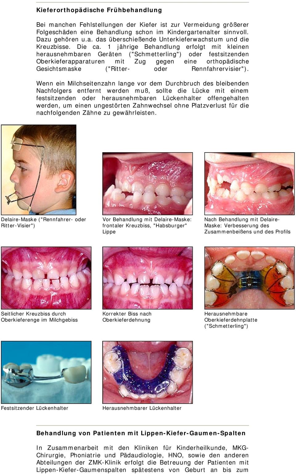 Zahnspange außenbogen Zahnspangen