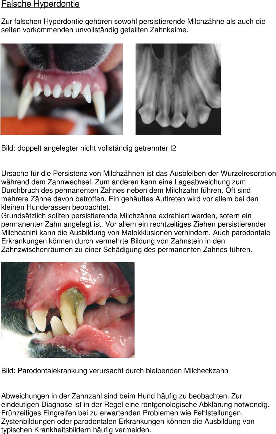 Zum anderen kann eine Lageabweichung zum Durchbruch des permanenten Zahnes neben dem Milchzahn führen. Oft sind mehrere Zähne davon betroffen.