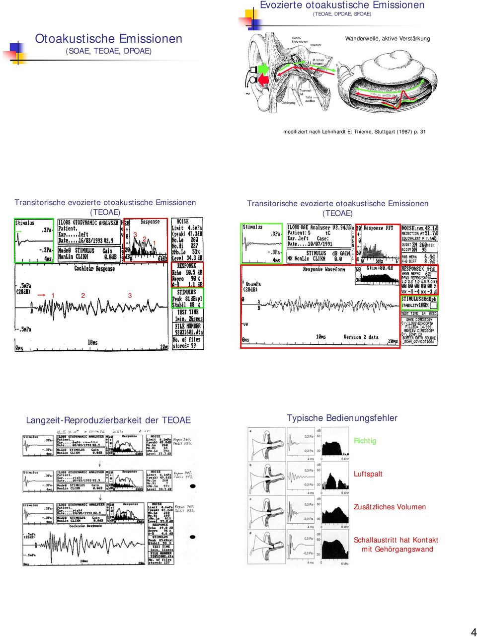 3 Transitorische evozierte otoakustische Emissionen (TEOAE) Transitorische evozierte otoakustische Emissionen (TEOAE) 3