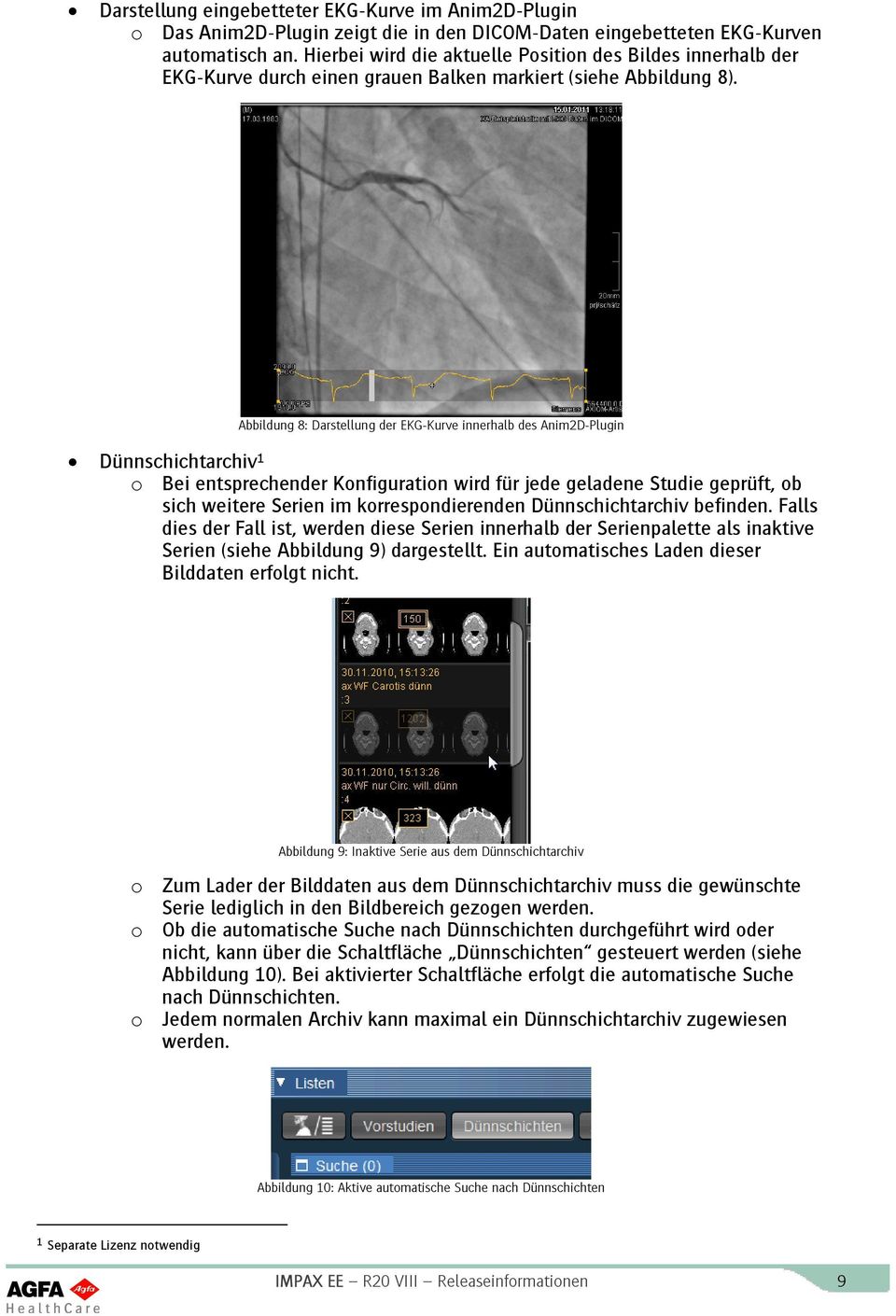 Abbildung 8: Darstellung der EKG-Kurve innerhalb des Anim2D-Plugin Dünnschichtarchiv 1 o Bei entsprechender Konfiguration wird für jede geladene Studie geprüft, ob sich weitere Serien im