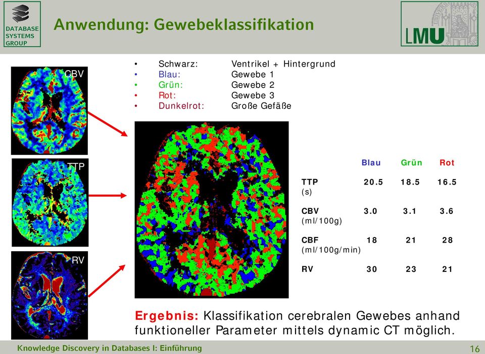 6 (ml/100g) RV RV CBF 18 21 28 (ml/100g/min) RV 30 23 21 Ergebnis: Klassifikation cerebralen Gewebes