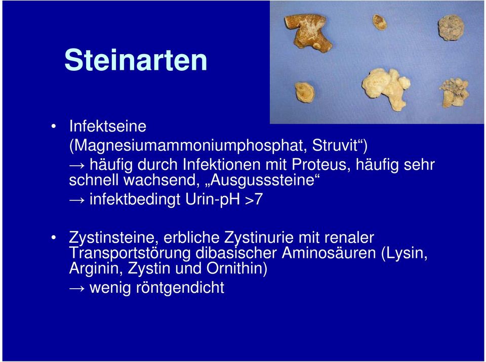 infektbedingt Urin-pH >7 Zystinsteine, erbliche Zystinurie mit renaler