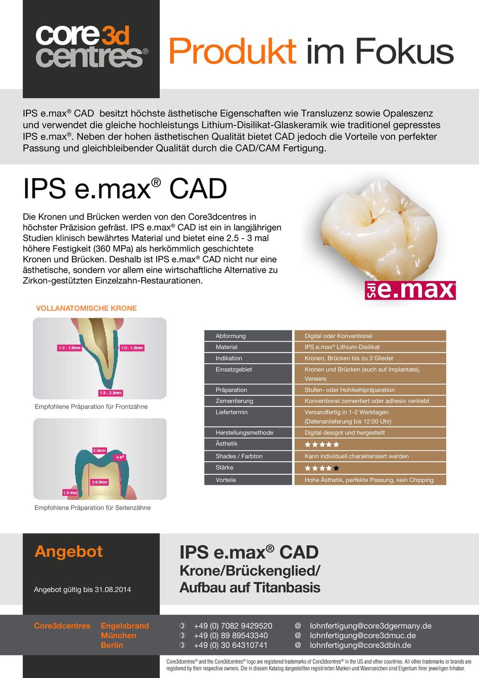 IPS e.max CAD Die Kronen und Brücken werden von den Core3dcentres in höchster Präzision gefräst. IPS e.max CAD ist ein in langjährigen Studien klinisch bewährtes Material und bietet eine 2.