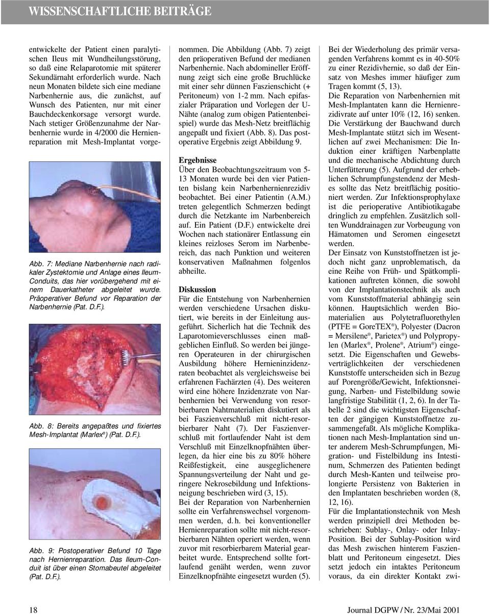 Nach stetiger Größenzunahme der Narbenhernie wurde in 4/2000 die Hernienreparation mit Mesh-Implantat vorge- Abb.